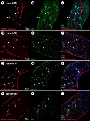 Pericyte-derived cells participate in optic nerve scar formation